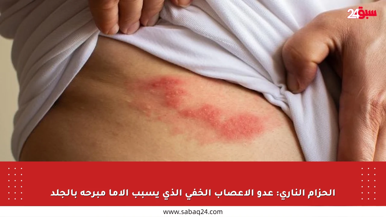 الحزام الناري: عدو الأعصاب الخفي الذي يسبب آلاما مبرحة بالجلد